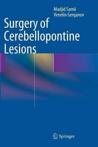Паперова книга «Surgery of Cerebellopontine Lesions», авторів Маджид Самій, Венелін Герганов - фото №1