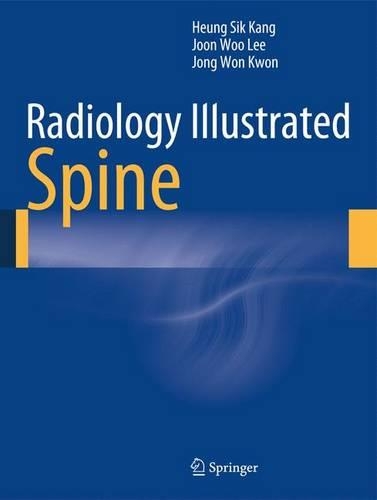 Бумажная книга «Radiology Illustrated: Spine», авторов Хын Сик Канг, Чон Вон Квон, Чжун У Ли - фото №1