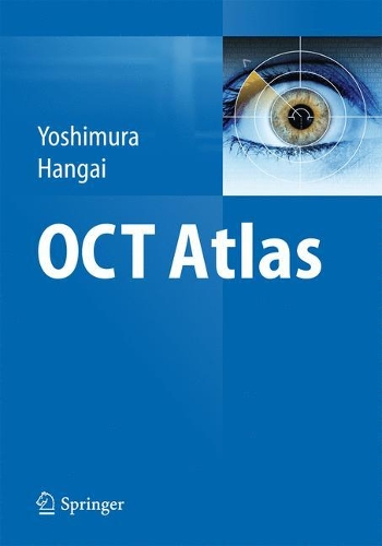 Паперова книга «OCT Atlas», авторів Масанорі Хангаі, Наґахіса Йошімура - фото №1