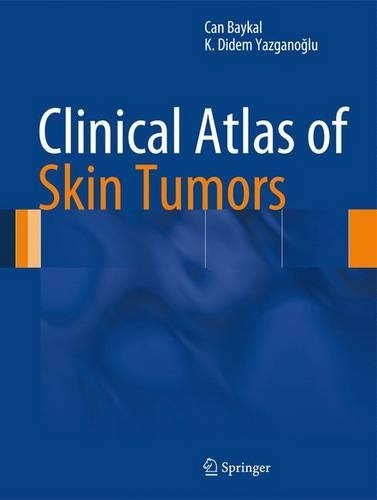 Паперова книга «Clinical Atlas of Skin Tumors», авторів Кан Байкал, К. Дідем Язганоглу - фото №1