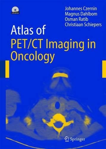 Паперова книга «Atlas of PET/CT Imaging in Oncology», авторів Крістіан Шіперс, Йоганнес Чернін, Магнус Дальбом, О. Ратіб - фото №1