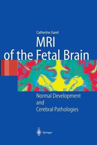 Паперова книга «MRI of the Fetal Brain: Normal Development and Cerebral Pathologies», автор К. Гарел - фото №1