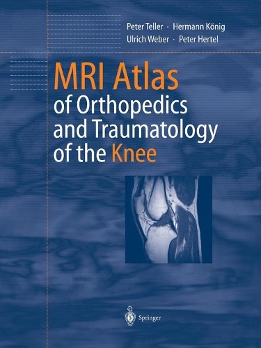Бумажная книга «MRI Atlas of Orthopedics and Traumatology of the Knee», авторов Герман Кёниг, Питер Хертель, Питер Теллер, Ульрих Вебер - фото №1