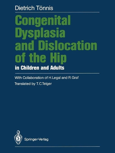 Бумажная книга «Congenital Dysplasia and Dislocation of the Hip in Children and Adults», автор Дитрих Тённис - фото №1