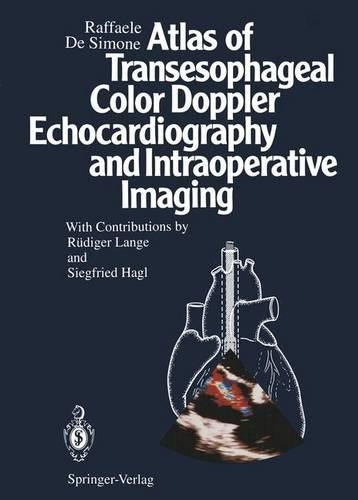Бумажная книга «Atlas of Transesophageal Color Doppler Echocardiography and Intraoperative Imaging», автор Раффаэле ДеСимоне - фото №1