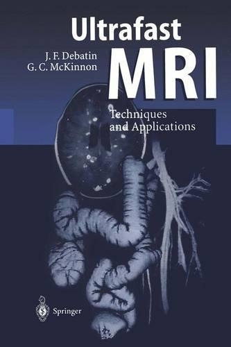 Бумажная книга «Ultrafast MRI: Techniques and Applications», авторов Грэм К. Маккиннон, Йорг Ф. Дебатин - фото №1