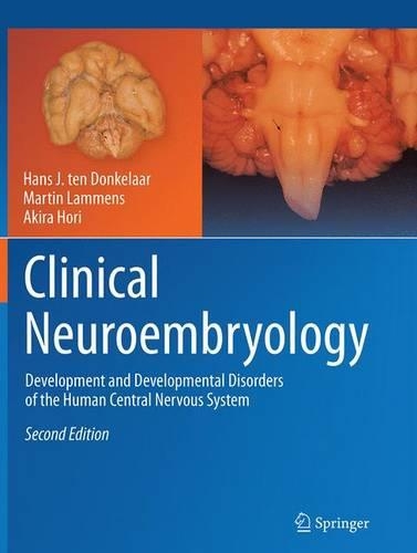Паперова книга «Clinical Neuroembryology: Development and Developmental Disorders of the Human Central Nervous System», авторів Акіра Хорі, Ганс Й. тен Донкелаар, Мартін Ламменс - фото №1