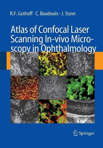 Бумажная книга «Atlas of Confocal Laser Scanning In-vivo Microscopy in Ophthalmology», авторов К. Бодуэн, Дж. Стейв, Р.Ф. Гутхофф - фото №1