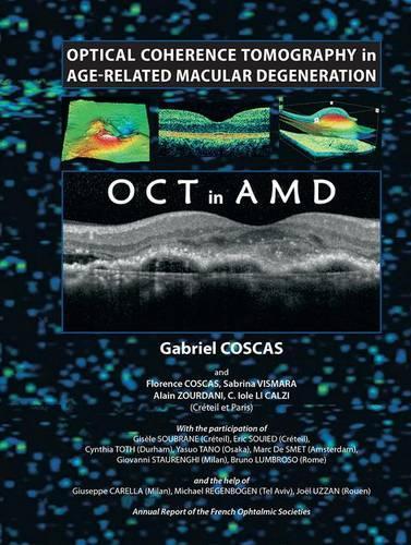 [object Object] «Optical Coherence Tomography in Age-Related Macular Degeneration», автор Габріель Коскас - фото №1