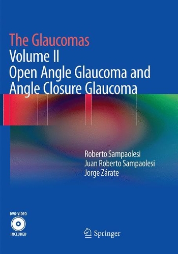 [object Object] «The Glaucomas: Volume II - Open Angle Glaucoma and Angle Closure Glaucoma», авторів Хорхе Зарате, Хуан Роберто Сампаолесі, Роберто Сампаолезі - фото №1