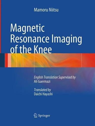 Бумажная книга «Magnetic Resonance Imaging of the Knee», автор Мамору Ниицу - фото №1