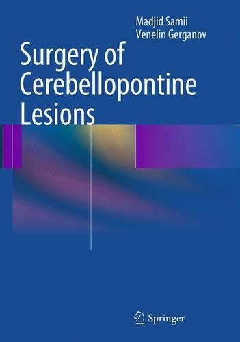 Паперова книга «Surgery of Cerebellopontine Lesions», авторів Маджид Самій, Венелін Герганов - фото №1