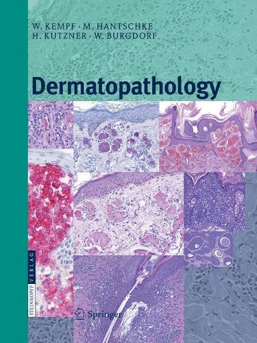Паперова книга «Dermatopathology», авторів Хайнц Куцнер, Маркус Ганчке, Вальтер Х.К. Бургдорф, Вернер Кемпф - фото №1