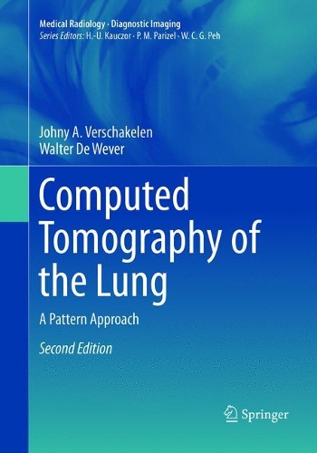 Паперова книга «Computed Tomography of the Lung: A Pattern Approach», авторів Джонні А. Вершакелен, Волтер Де Вевер - фото №1