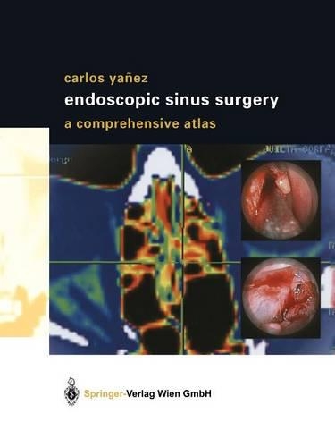 Бумажная книга «Endoscopic Sinus Surgery: A Comprehensive Atlas», автор Карлос Яньес - фото №1