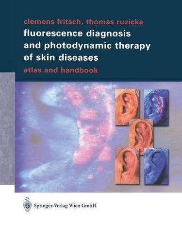 Бумажная книга «Fluorescence Diagnosis and Photodynamic Therapy of Skin Diseases: Atlas and Handbook», авторов Клеменс Фрич, Томас Ружичка - фото №1
