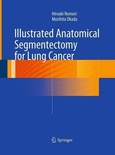 Паперова книга «Illustrated Anatomical Segmentectomy for Lung Cancer», авторів Хіроакі Номорі, Моріхіто Окада - фото №1