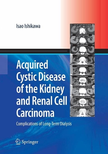 Бумажная книга «Acquired Cystic Disease of the Kidney and Renal Cell Carcinoma: Complication of Long-Term Dialysis», автор Исао Исикава - фото №1