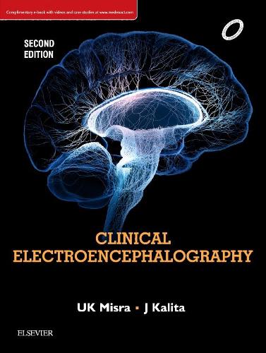 Бумажная книга «Clinical Electroencephalography», авторов Дж Калита, У. К. Мисра - фото №1