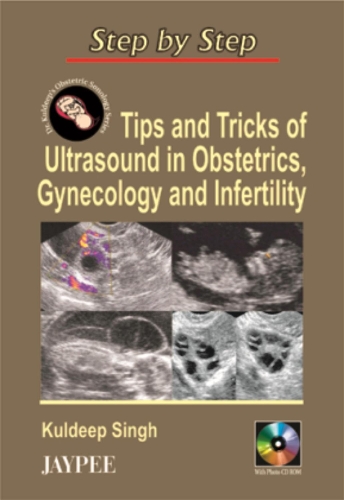 Бумажная книга «Step by Step: Tips & Tricks of Ultrasound in Obstetrics, Gynecology & Infertility», автор Кулдип Сингх - фото №1