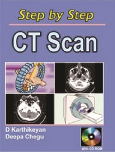 Паперова книга «Step by Step CT Scan», авторів Д. Картікеян, Діпа Чегу - фото №1