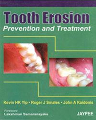 Паперова книга «Tooth Erosion Prevention and Treatment», авторів Джон А. Кайдоніс, Кевін Х.К. Іп, Роджер Джей Смейлз - фото №1