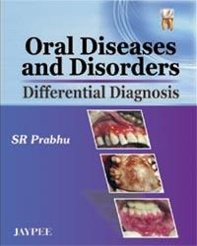Бумажная книга «Oral Diseases and Disorders: Differential Diagnosis», автор Ш. Р. Прабгу - фото №1
