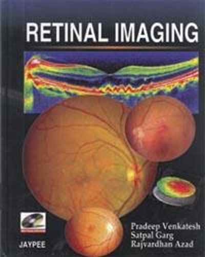 Паперова книга «Retinal Imaging», авторів Прадіп Венкатеш, Радж Вардхан Азад, Сатпал Гарг - фото №1