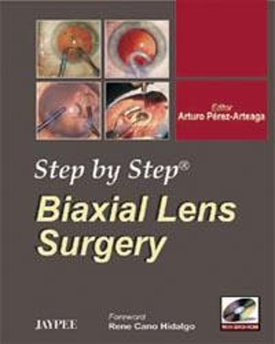 Бумажная книга «Step by Step: Biaxial Lens Surgery», автор Артуро Перес Артеага - фото №1