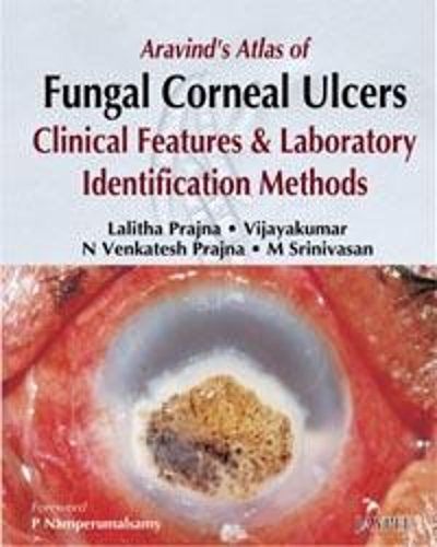 Паперова книга «Aravind's Atlas of Fungal Corneal Ulcers», авторів Лаліта Праджна, М Шрінівасан, Н. Венкатеш Праджина - фото №1