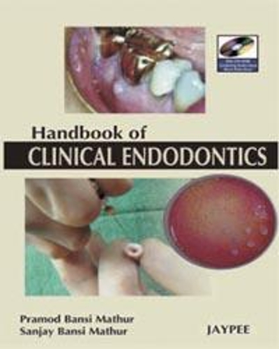 Паперова книга «A Hand Book of Clinical Endodontics», авторів Прамод Бансі Матхур, Санджай Бансі Матхур - фото №1