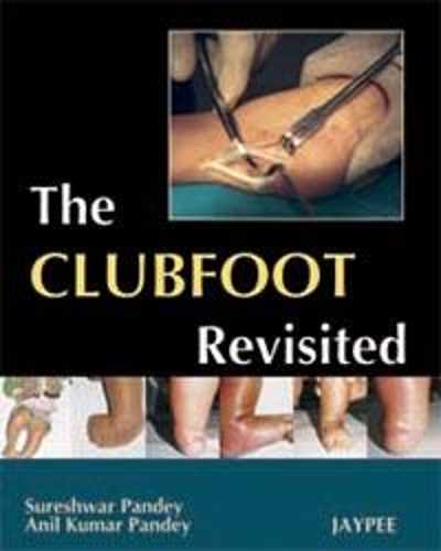 Бумажная книга «The Club Foot Revisited», авторов Анил Кумар Пандей, Сурешвар Пандей - фото №1