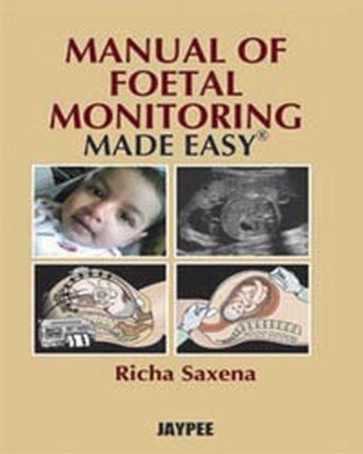 Паперова книга «Manual of Fetal Monitoring Made Easy», автор Річа Саксена - фото №1