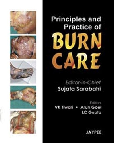 Бумажная книга «Principles and Practice of Burn Care», автор Суджата Сарабахи - фото №1