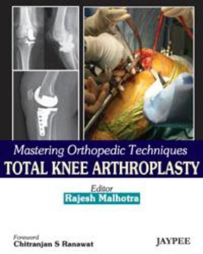Паперова книга «Mastering Orthopedic Techniques: Total Knee Arthroplasty», автор Раджеш Малхотра - фото №1