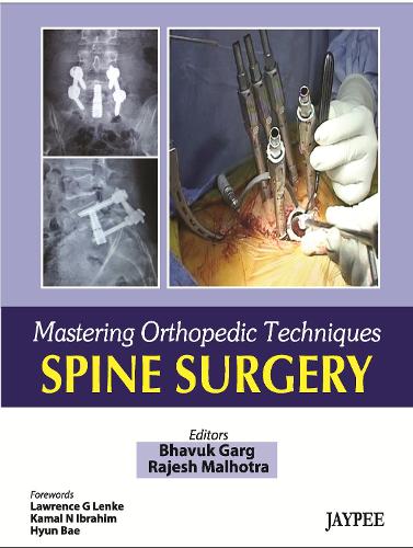 Паперова книга «Mastering Orthopaedic Techniques Spine Surgery», авторів Бхавук Гарг, Раджеш Малхотра - фото №1
