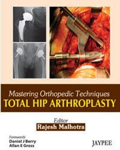 Паперова книга «Mastering Orthopedic Techniques: Total Hip Arthroplasty», автор Раджеш Малхотра - фото №1