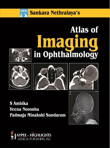 Паперова книга «Atlas of Imaging in Ophthalmology», авторів Падмаджа Мінакші Сундарам, С. Амбіка, Віна Норонья - фото №1