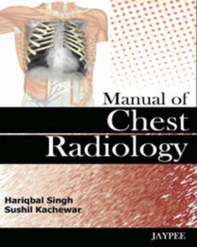 Бумажная книга «Manual of Chest Radiology», авторов Харикбал Сингх, Сушил Качевар - фото №1