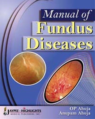 Бумажная книга «Manual of Fundus Diseases», авторов Анупам Ахуджа, ОП Ахуджа - фото №1