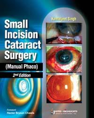 Бумажная книга «Small Incision Cataract Surgery (Manual Phaco)», автор Камальджит Сингх - фото №1