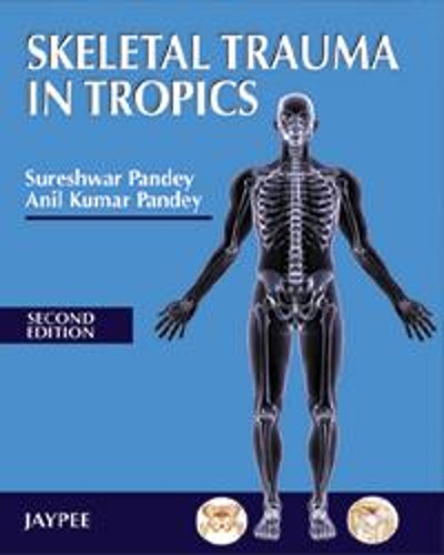Паперова книга «Skeletal Trauma in Tropics», автор Сурешвар Пандей - фото №1