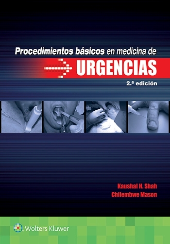 Паперова книга «Procedimientos básicos en medicina de urgencias», автор Каушал Х. Шах - фото №1
