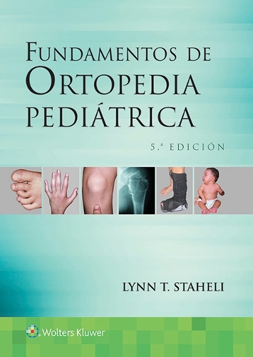 Паперова книга «Fundamentos de ortopedia pediátrica», автор Лінн Т. Стагелі - фото №1