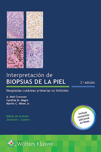 Бумажная книга «Interpretación de biopsias de la piel: Neoplasias cutáneas primarias no linfoides», авторов А. Нил Кроусон, Синтия М. Магро, Мартин К. Мим - фото №1