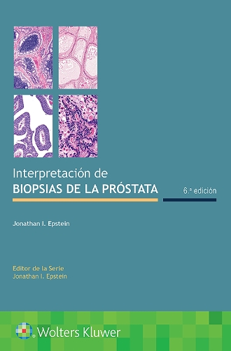 Бумажная книга «Interpretación de biopsias de la próstata», автор Джонатан И. Эпштейн - фото №1