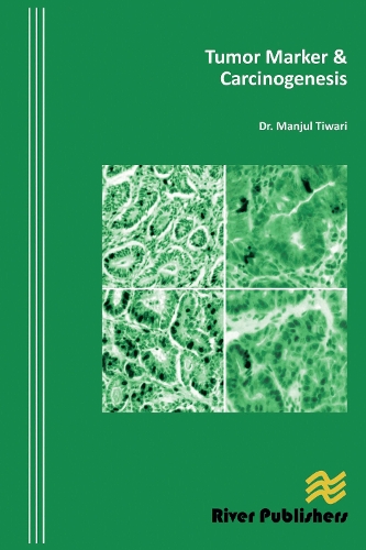 Бумажная книга «Tumor Marker and Carcinogenesis», автор Манджул Тивари - фото №1