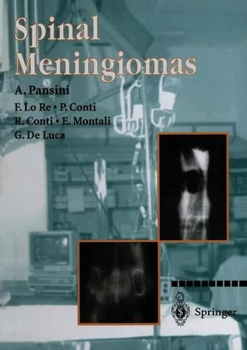 Паперова книга «Spinal Meningiomas», авторів А. Пансіні, Е. Монталі, Ф. Ло Ре, Г. Де Лука, П. Конті - фото №1