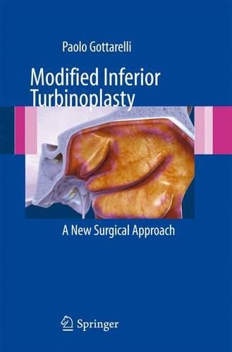 Бумажная книга «Modified Inferior Turbinoplasty: A new surgical approach», автор Паоло Готтарелли - фото №1