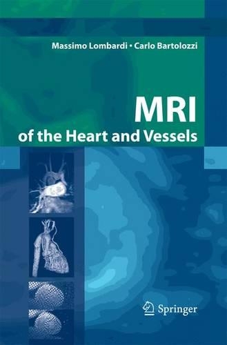 Паперова книга «MRI of the Heart and Vessels», авторів Карло Бартолоцці, Массімо Ломбарді - фото №1